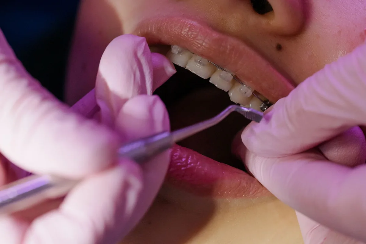 Un orthodontiste ajuste un appareil dentaire multibague sur une adolescente assise dans un fauteuil de cabinet dentaire